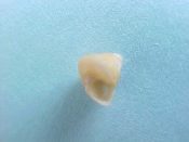 ....30609...(1)...Calliostoma coppingeri Smith, 1880....5 mm. F+. Pastel orange-tan micro Trochid...Argentina...$9 (1 available)