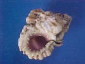 (3) Bursa mammata Roding, 1798....36 to 42 mm. F. A bit beach-worn but with good lips and purple appertures...Somalia...$5 (3 available)